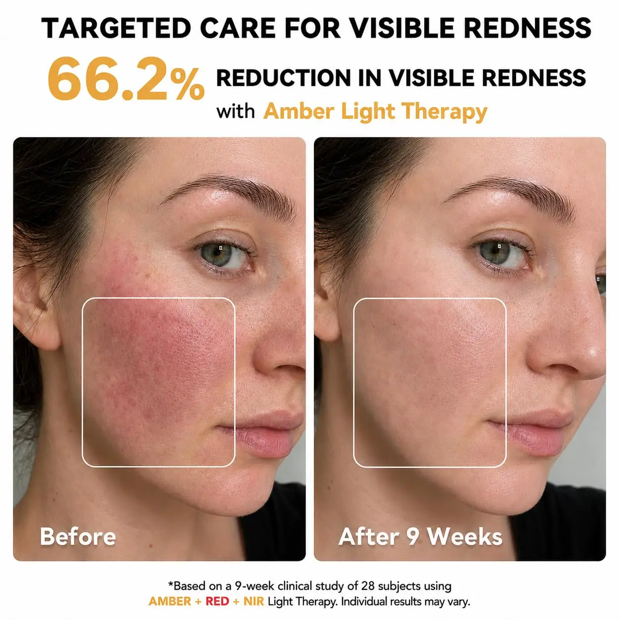 MICEYLIVE face light therapy collection